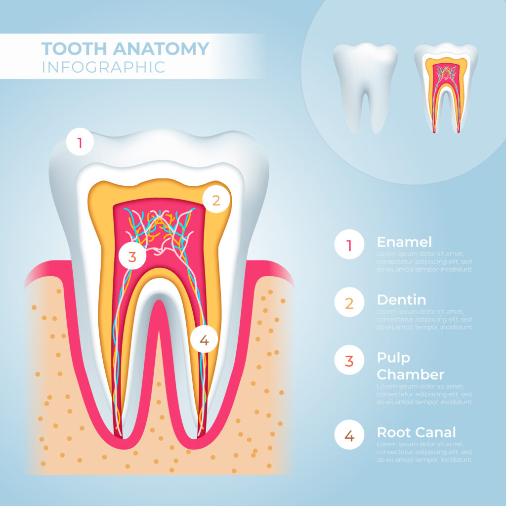 root canal treatment